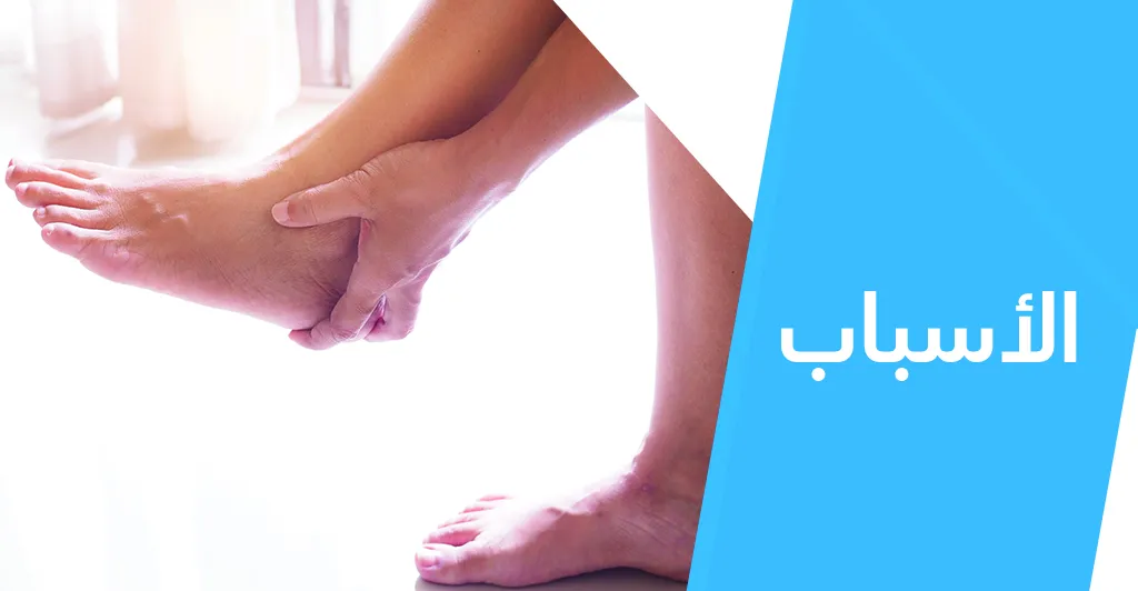 ماهو مرض الدّوالي وماهي أعراضه ؟